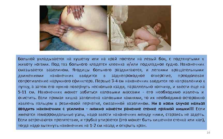 Больной укладывается на кушетку или на край постели на левый бок,  с подтянутыми