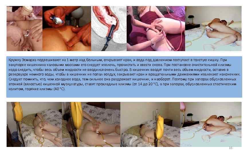 Кружку Эсмарха подвешивают на 1 метр над больным, открывают кран, и вода под давлением