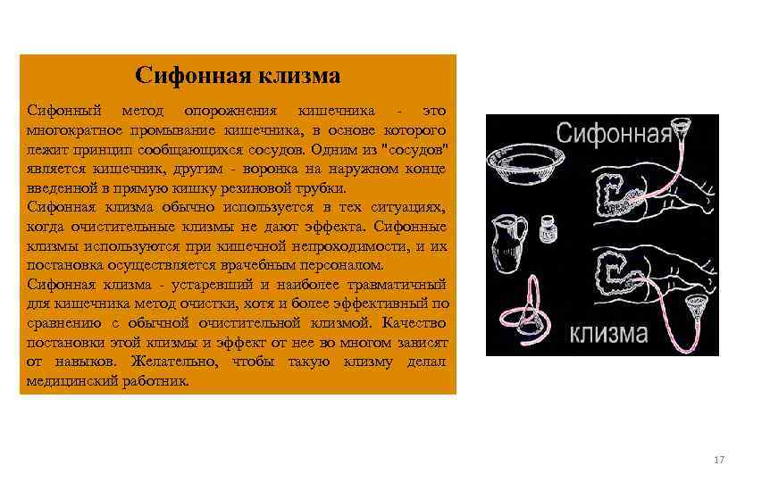    Сифонная клизма Сифонный метод опорожнения кишечника - это многократное промывание кишечника,