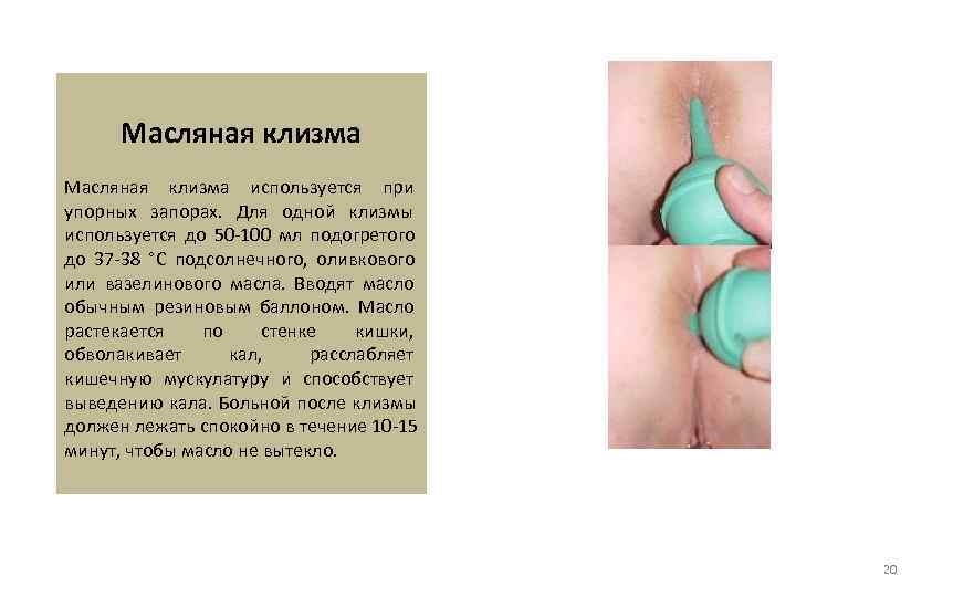  Масляная клизма используется при упорных запорах.  Для одной клизмы используется до 50