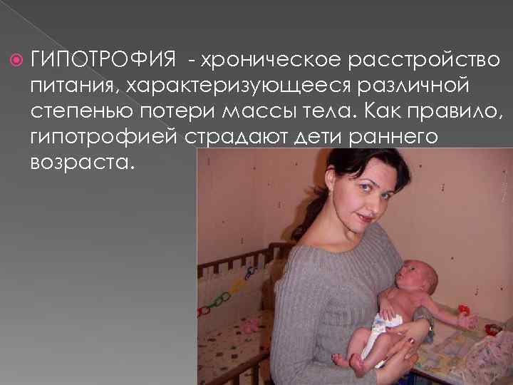   ГИПОТРОФИЯ - хроническое расстройство питания, характеризующееся различной степенью потери массы тела. Как