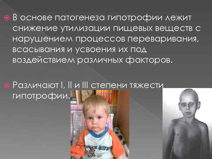   В основе патогенеза гипотрофии лежит снижение утилизации пищевых веществ с нарушением процессов