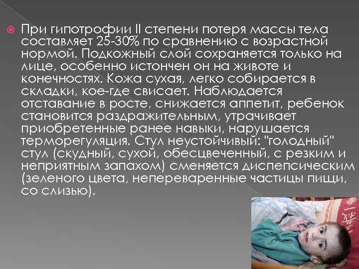   При гипотрофии II степени потеря массы тела составляет 25 -30% по сравнению