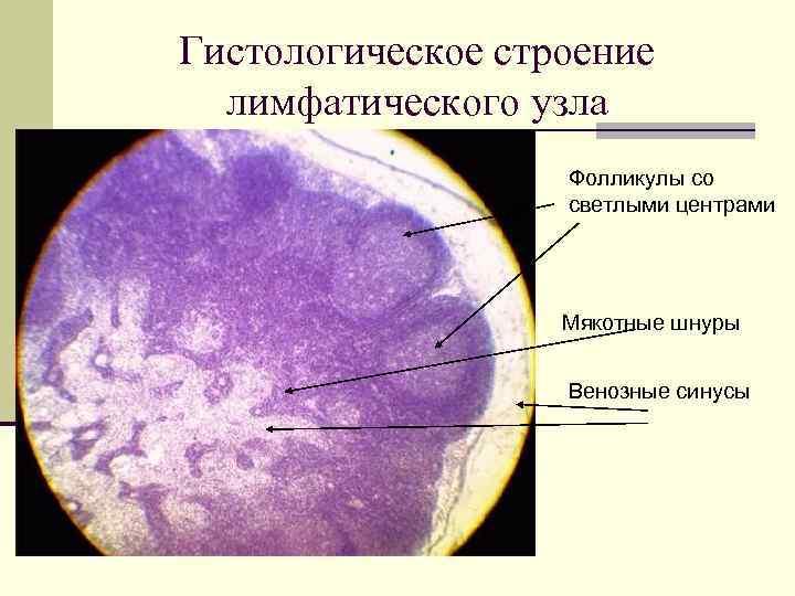 Лимфоузел гистология рисунок