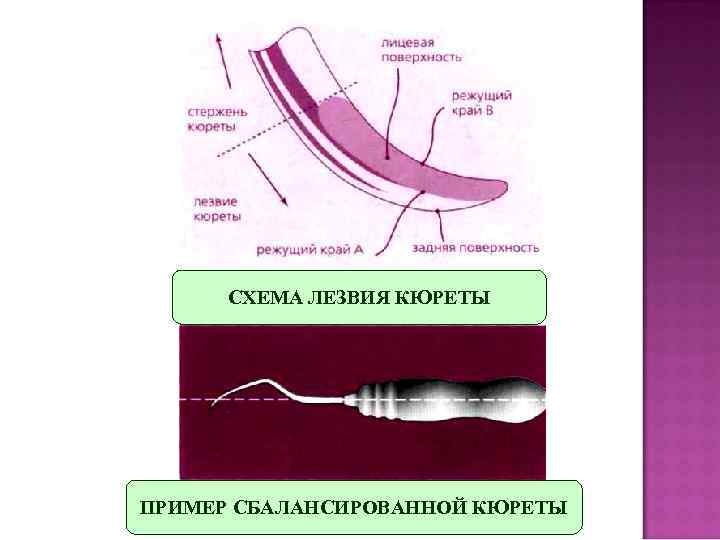 Методы удаления зубных отложений презентация