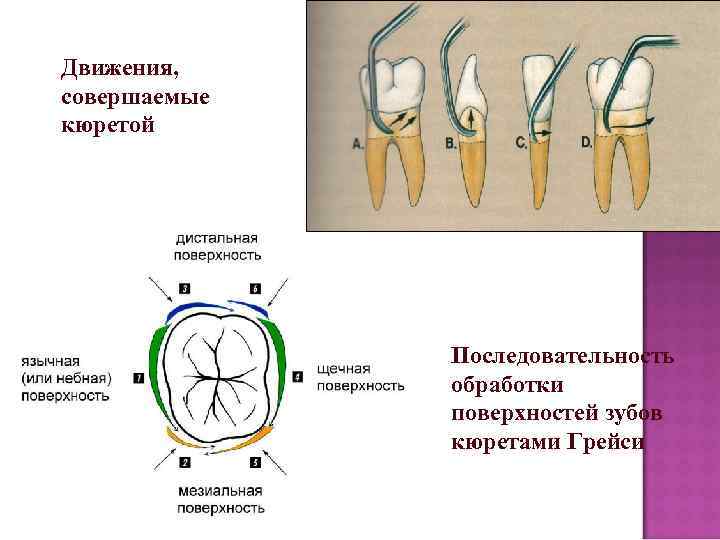 Движения, совершаемые кюретой    Последовательность    обработки   
