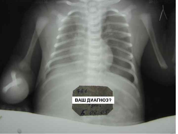 ВАШ ДИАГНОЗ? 