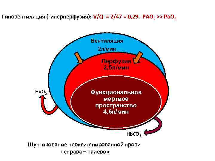 Гиповентиляция (гиперперфузия): V/Q = 2/47 = 0, 29. PAO 2 >> Pa. O 2