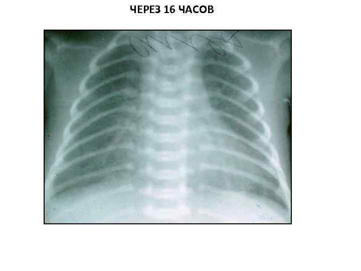 ЧЕРЕЗ 16 ЧАСОВ 