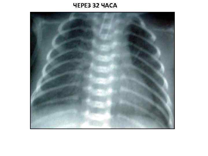 ЧЕРЕЗ 32 ЧАСА 