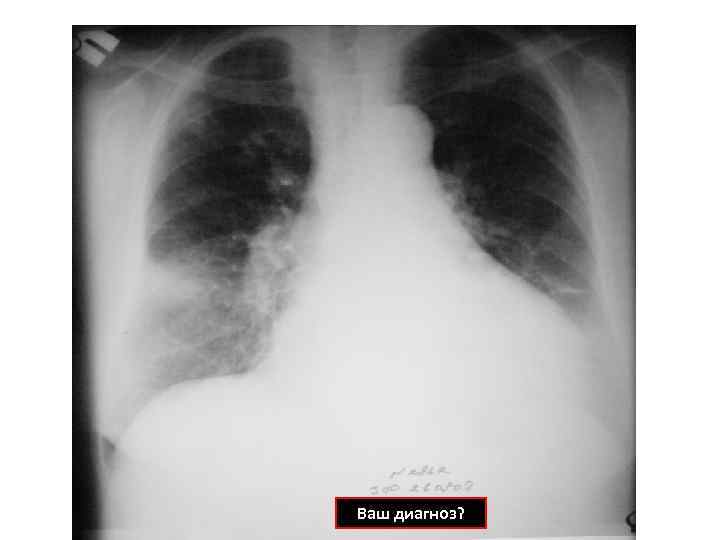 Ваш диагноз? 