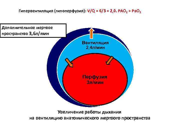   Гипервентиляция (гипоперфузия): V/Q = 6/3 = 2, 0. PAO 2 > Pa.