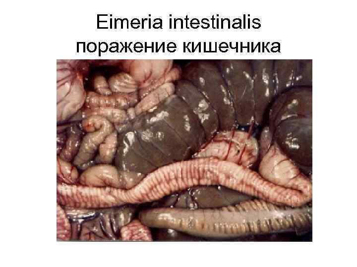  Eimeria intestinalis поражение кишечника 