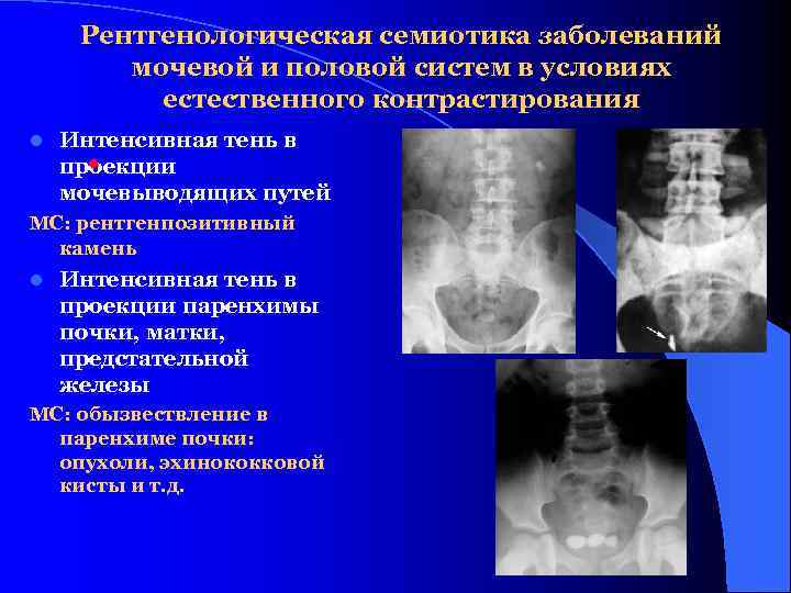 Семиотика в архитектуре