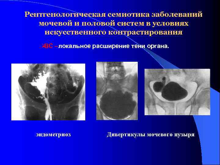 Лучевая семиотика заболеваний органов мочевыделительной системы презентация