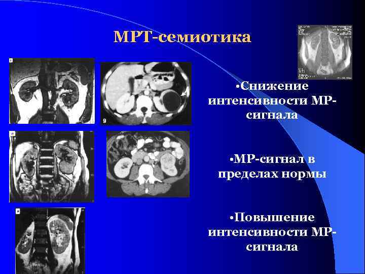 Лучевая анатомия семиотика