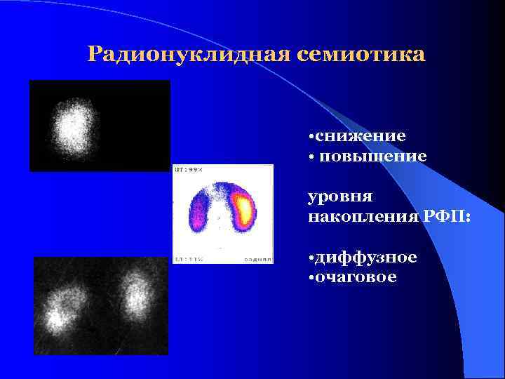 Радионуклидная семиотика    • снижение   • повышение   уровня