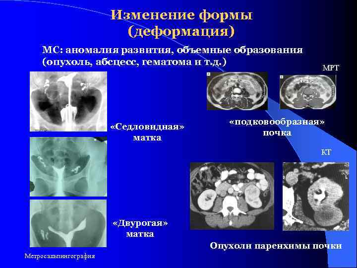     Изменение формы     (деформация) МС: аномалия развития,