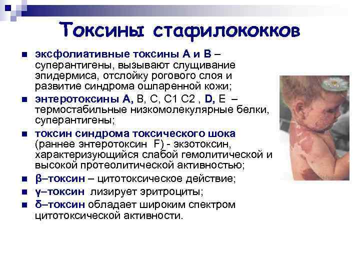   Токсины стафилококков n  эксфолиативные токсины А и В – суперантигены, вызывают