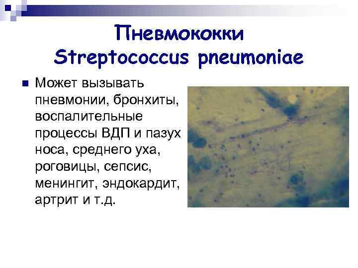   Пневмококки  Streptococcus pneumoniae n  Может вызывать пневмонии, бронхиты, воспалительные процессы