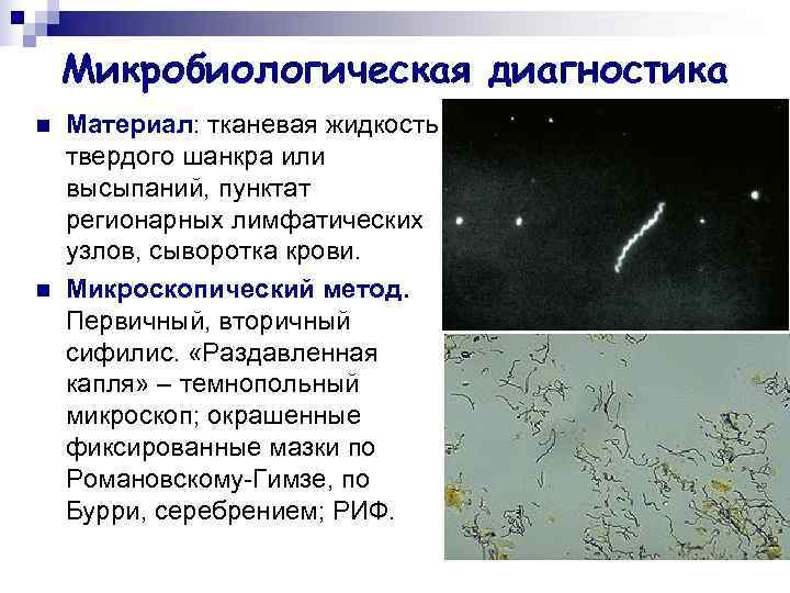   Микробиологическая диагностика n  Материал: тканевая жидкость твердого шанкра или высыпаний, пунктат