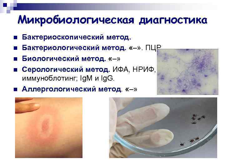 Микробиологическая диагностика n  Бактериоскопический метод. n  Бактериологический метод.  «–» . ПЦР.