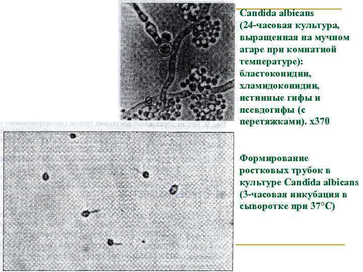 Candida albicans (24 часовая культура, выращенная на мучном агаре при комнатной температуре): бластоконидии, хламидоконидии,