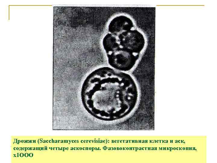 Дрожжи (Saccharamyces cerevisiae): вегетативная клетка и аск, содержащий четыре аскоспоры. Фазовоконтрастная микроскопия, х1 ООО