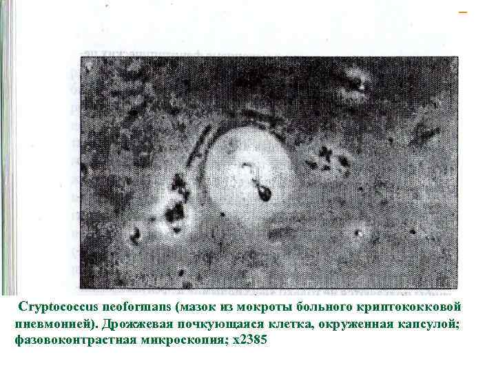 Cryptococcus neoformans (мазок из мокроты больного криптококковой пневмонией). Дрожжевая почкующаяся клетка, окруженная капсулой; фазовоконтрастная