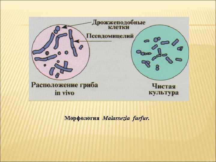 Морфология Malassezia furfur. 