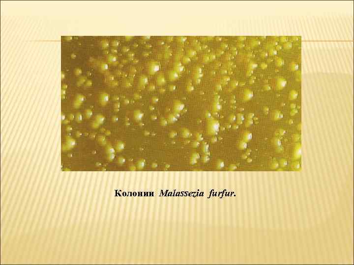 Колонии Malassezia furfur. 