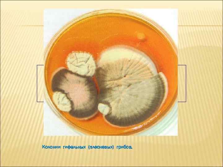 Колонии гифальных (плесневых) грибов. 