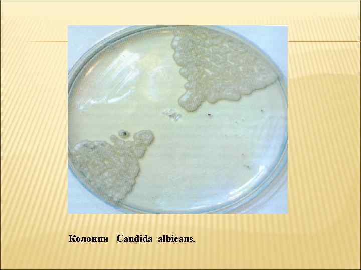 Колонии Candida albicans. 