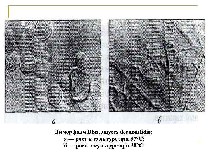 Диморфизм Blastomyces dermatitidis:  а — рост в культуре при 37°С;  б —