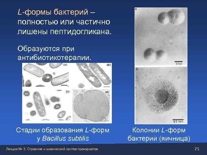  L-формы бактерий –  полностью или частично  лишены пептидогликана.   Образуются