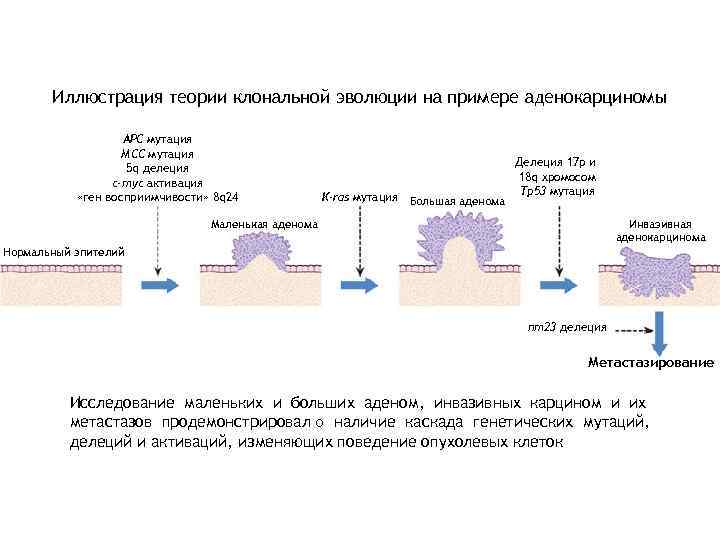   Иллюстрация теории клональной эволюции на примере аденокарциномы     APC