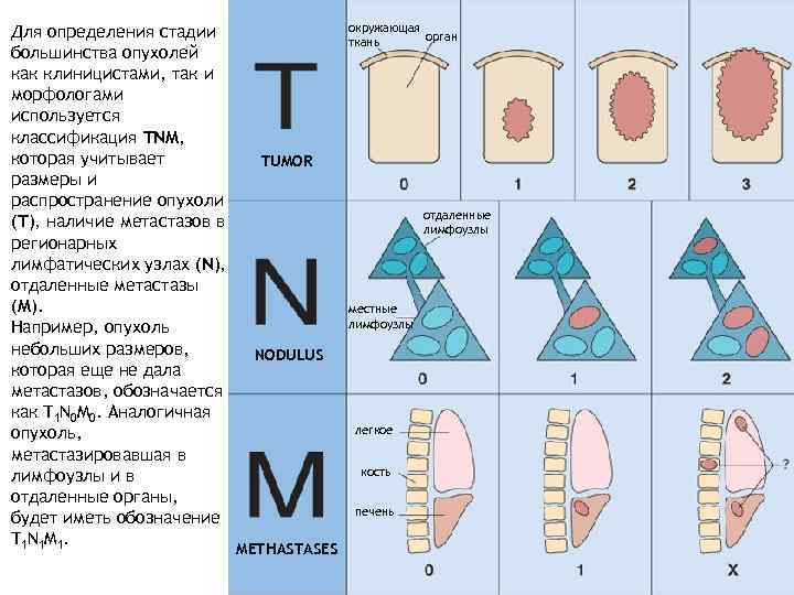 Классификация опухолей схема