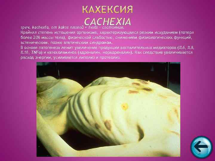 греч. kachexia, от kakos плохой + hexis – состояние. Крайняя степень истощения организма, характеризующаяся