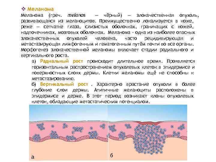 v Меланома (греч. melanos  — чёрный) — злокачественная опухоль, развивающаяся из меланоцитов. Преимущественно