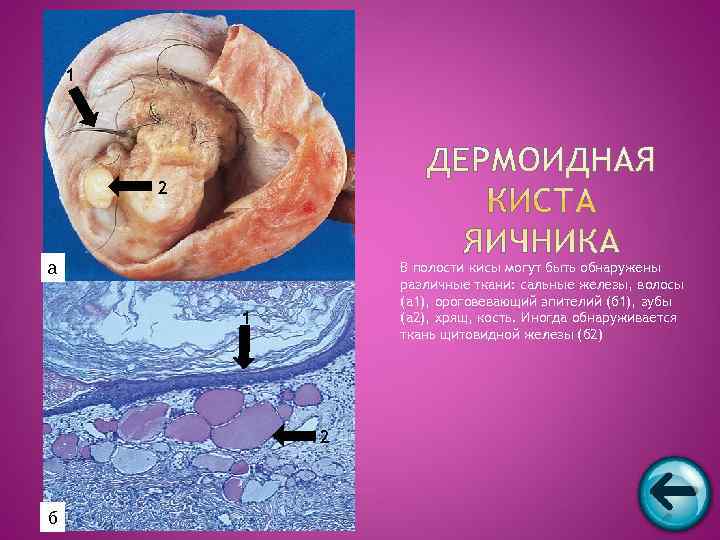   1   2  а    В полости кисы