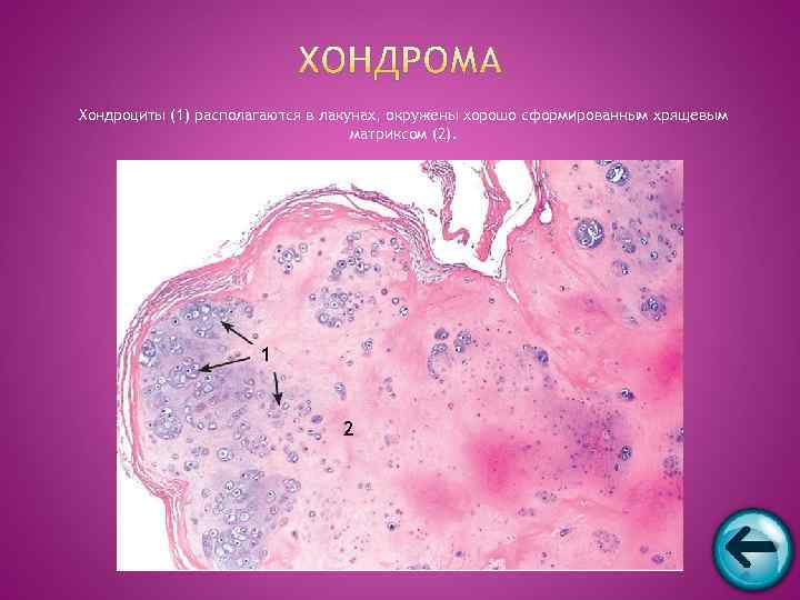 Хондроциты (1) располагаются в лакунах, окружены хорошо сформированным хрящевым     