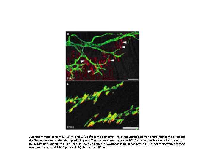 Diaphragm muscles from E 14. 5 (a) and E 18. 5 (b) control embryos