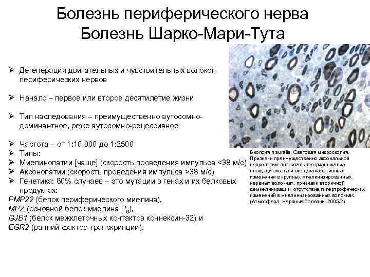   Болезнь периферического нерва    Болезнь Шарко-Мари-Тута Ø Дегенерация двигательных и