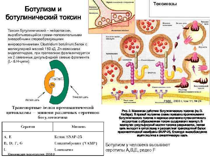 Ботулизм патогенез схема