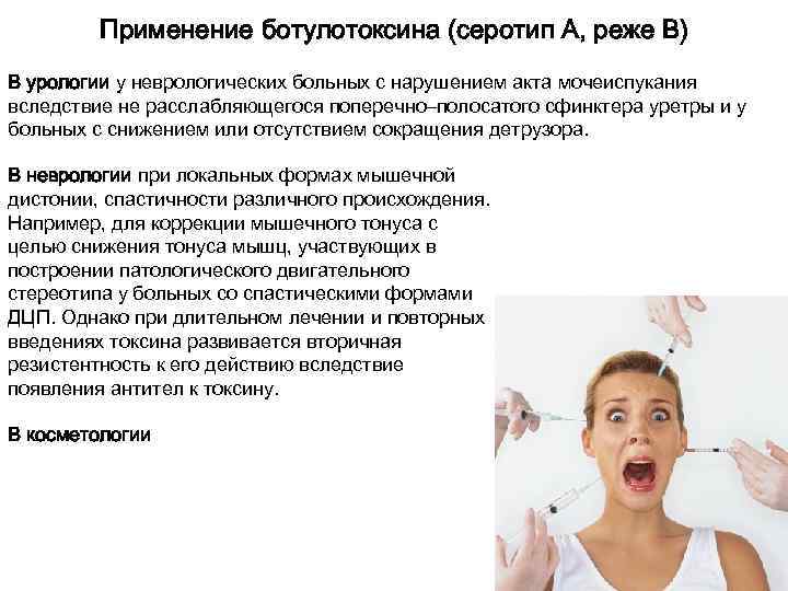    Применение ботулотоксина (серотип А, реже B) В урологии у неврологических больных