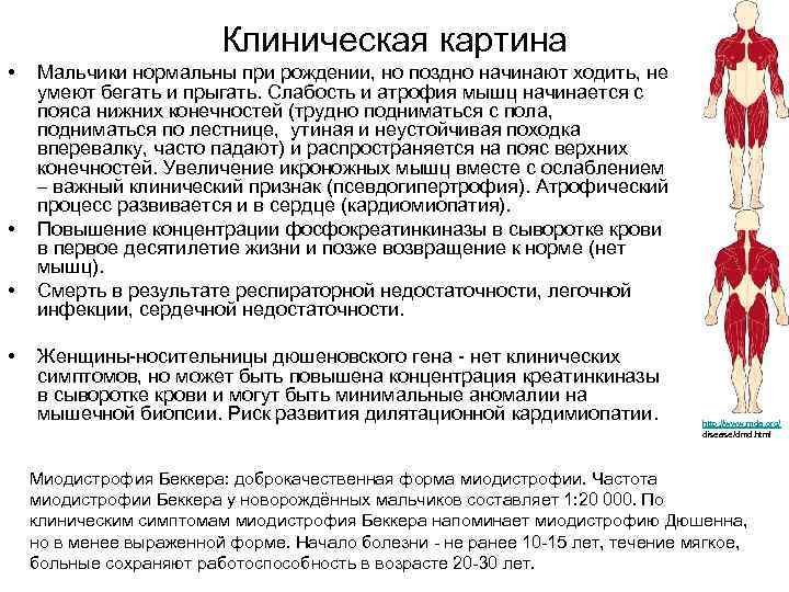      Клиническая картина •  Мальчики нормальны при рождении, но