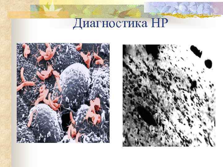 Диагностика НР   n 