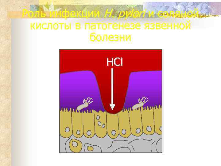 Роль инфекции H. pylori и соляной кислоты в патогенезе язвенной   болезни 