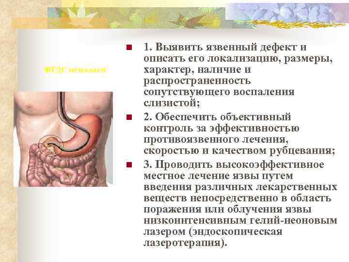    n  1. Выявить язвенный дефект и    описать