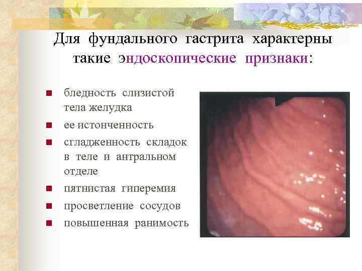   Для фундального гастрита характерны   такие эндоскопические признаки:  n 